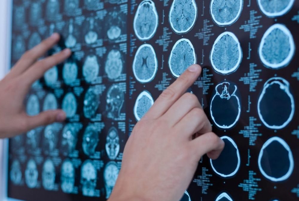 Common Causes of Traumatic Brain Injuries