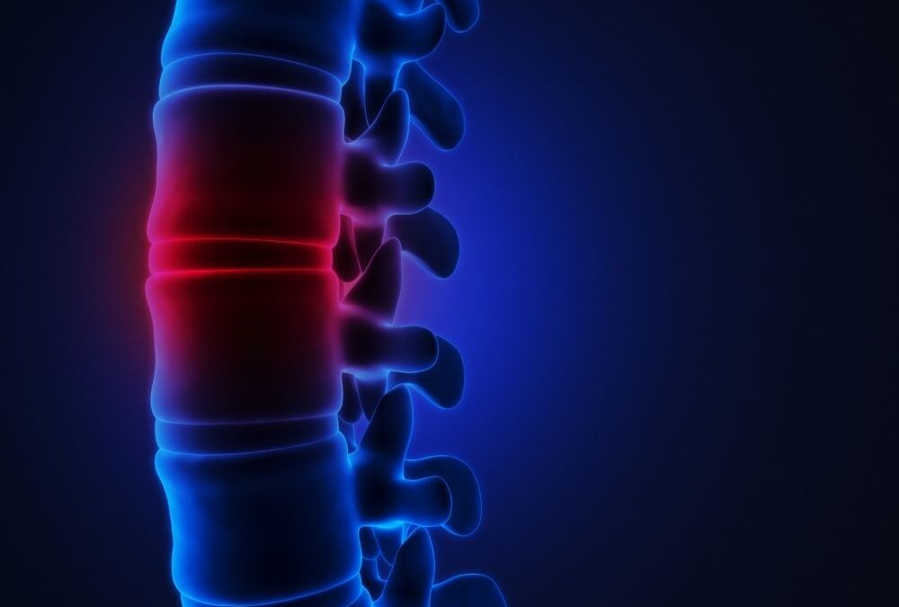 Women’s Spinal Cord Sport Injuries