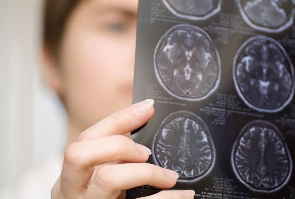 Understanding the Stigma That Can Accompany Traumatic Brain Injuries