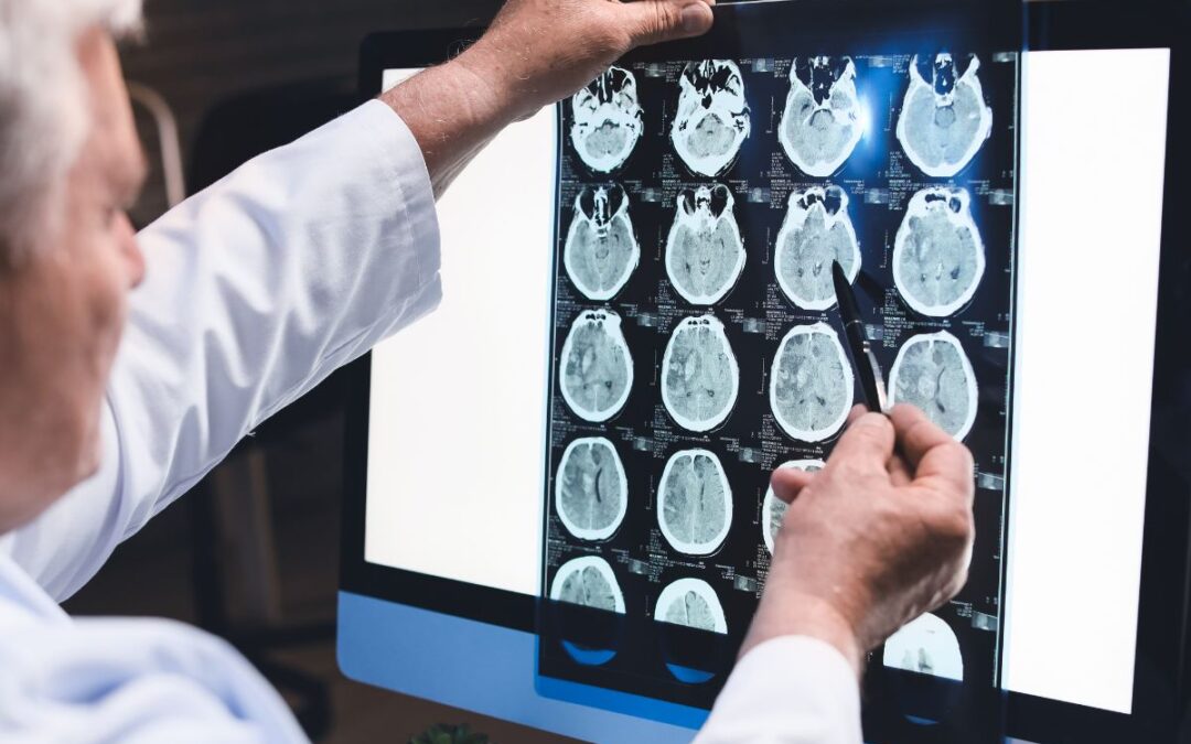 Study Explains Why Traumatic Brain Injury Survivors Lose Cognitive Function