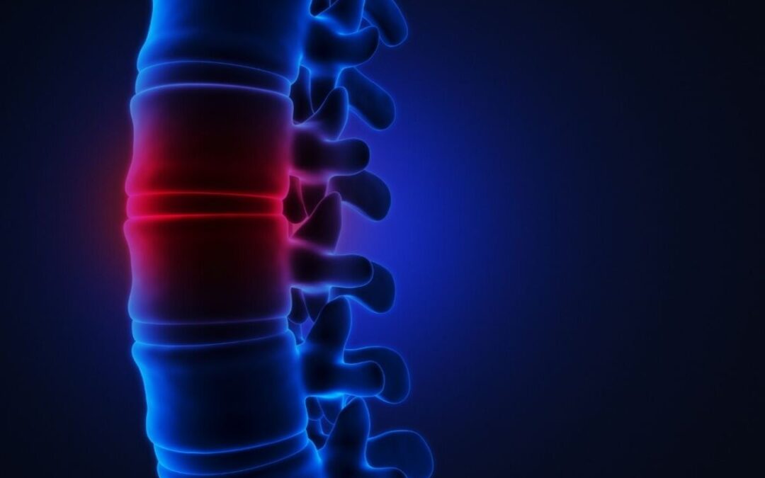 Do You Need a Lawyer After a Spinal Cord Injury?