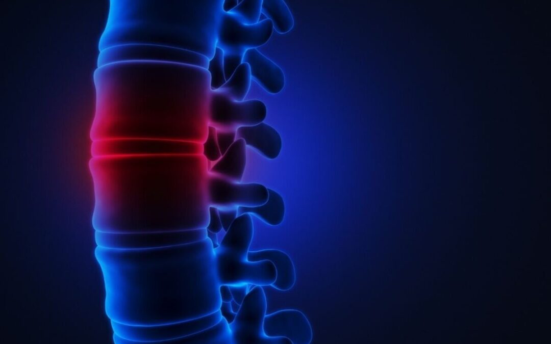 Five Things You Should Know About Spinal Cord Injuries