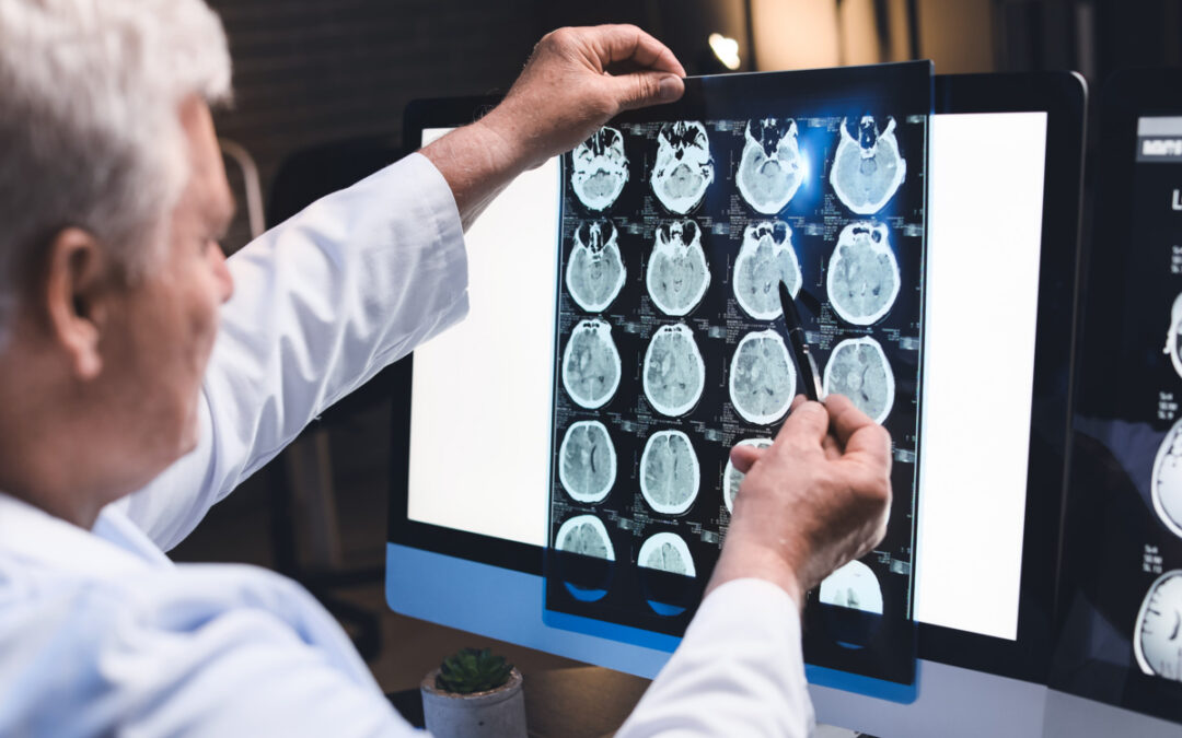 neurologist to support a traumatic brain injury claim